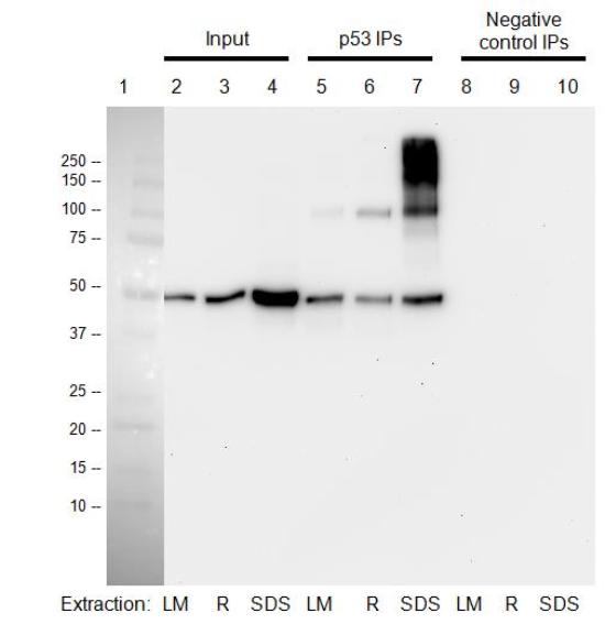 Immunoprecipitation - p53 Human Immunocapture Kit (AB154470), expandable thumbnail