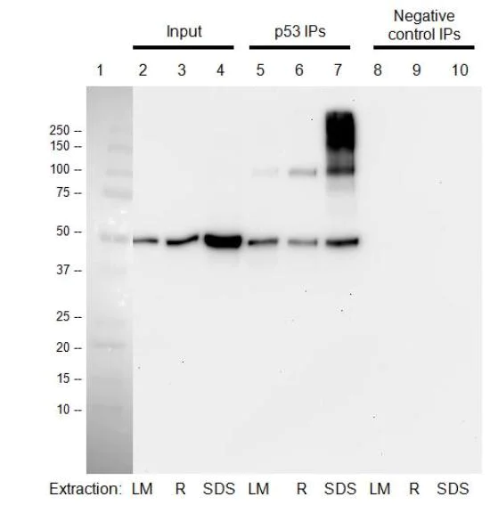 Immunoprecipitation - p53 Human Immunocapture Kit (AB154470)