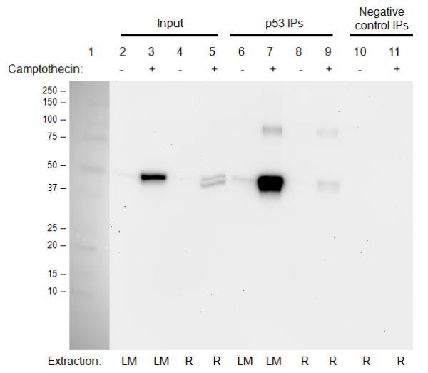 Immunoprecipitation - p53 Human Immunocapture Kit (AB154470), expandable thumbnail