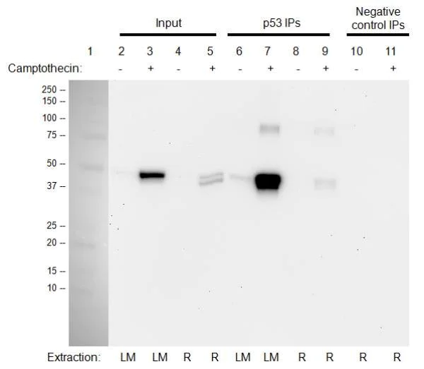 Immunoprecipitation - p53 Human Immunocapture Kit (AB154470)