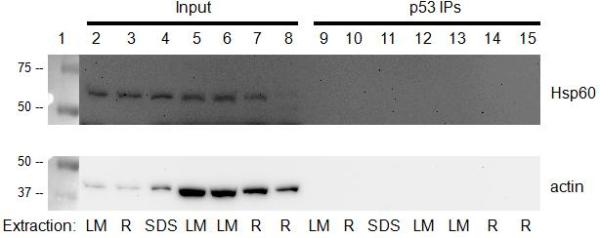 Immunoprecipitation - p53 Human Immunocapture Kit (AB154470), expandable thumbnail