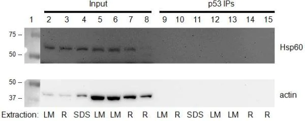 Immunoprecipitation - p53 Human Immunocapture Kit (AB154470)