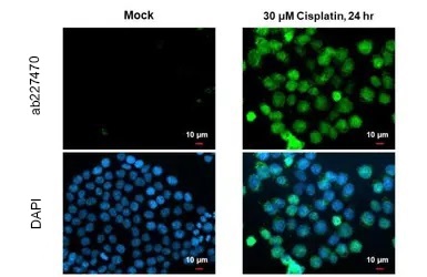 Immunocytochemistry/ Immunofluorescence - Anti-p53 (mono methyl K372) antibody (AB227470)