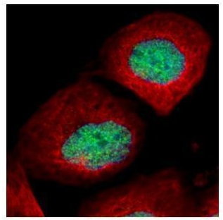 Immunocytochemistry/ Immunofluorescence - Anti-p53 (mono methyl K372) antibody (AB227470), expandable thumbnail