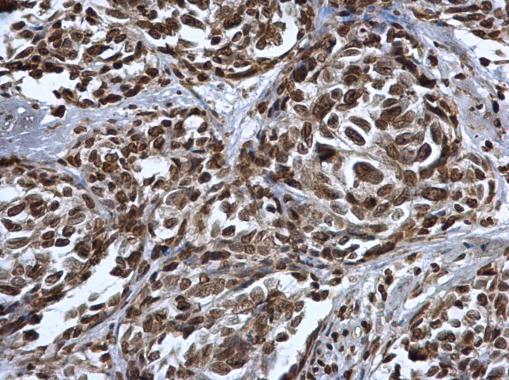 Immunohistochemistry (Formalin/PFA-fixed paraffin-embedded sections) - Anti-p53 (mono methyl K372) antibody (AB227470), expandable thumbnail