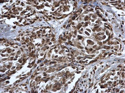 Immunohistochemistry (Formalin/PFA-fixed paraffin-embedded sections) - Anti-p53 (mono methyl K372) antibody (AB227470)