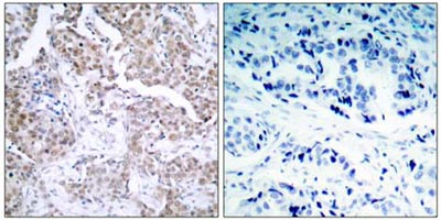 Immunohistochemistry (Formalin/PFA-fixed paraffin-embedded sections) - Anti-p53 (phospho S15) antibody (AB38497), expandable thumbnail