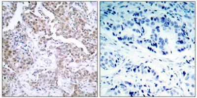 Immunohistochemistry (Formalin/PFA-fixed paraffin-embedded sections) - Anti-p53 (phospho S15) antibody (AB38497)