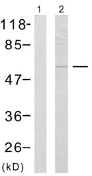 Western blot - Anti-p53 (phospho S15) antibody (AB38497)