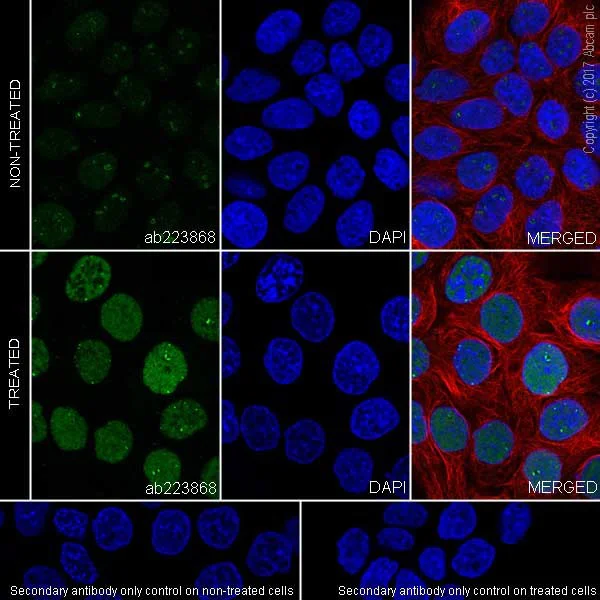 Immunocytochemistry/ Immunofluorescence - Anti-p53 (phospho S15) antibody [EPR64(N)] - BSA and Azide free (AB238982)