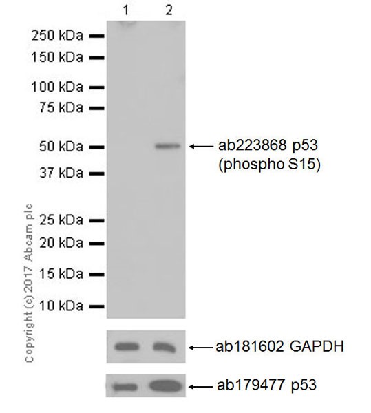 Western blot - Anti-p53 (phospho S15) antibody [EPR64(N)] - ChIP Grade (AB223868), expandable thumbnail