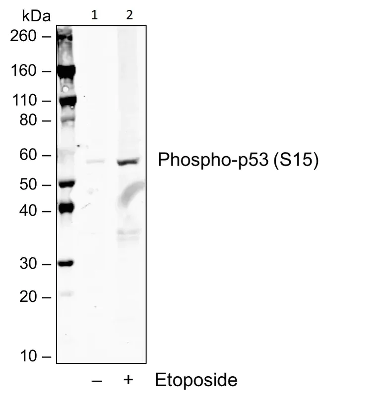 Western blot - Anti-p53 (phospho S15) antibody [P53S15-1C11] (AB278683)