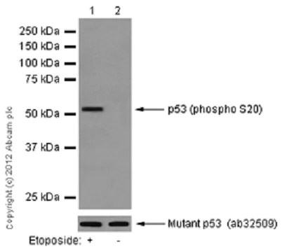Western blot - Anti-p53 (phospho S20) antibody [EPR2156(2)] (AB157454)