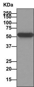 Immunoprecipitation - Anti-p53 (phospho S20) antibody [EPR2156(2)] - BSA and Azide free (AB249325), expandable thumbnail