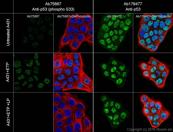 Anti-p53 (phospho S33) antibody [EP2393Y]