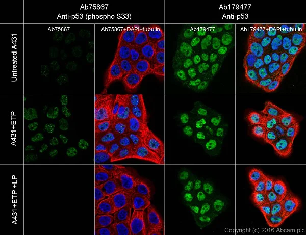 Immunocytochemistry/ Immunofluorescence - Anti-p53 (phospho S33) antibody [EP2393Y] (AB75867)