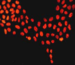 Immunocytochemistry/ Immunofluorescence - Anti-p53 (phospho S33) antibody [EP2393Y] (AB75867)