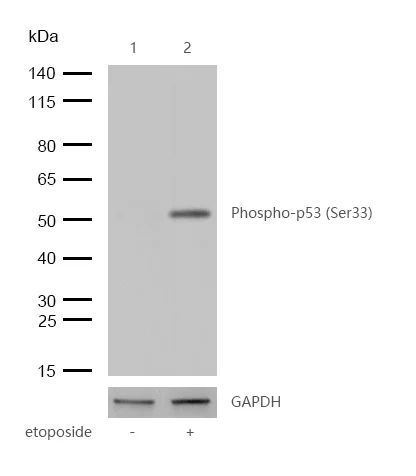 Western blot - Anti-p53 (phospho S33) antibody [SR1942] (AB326642)