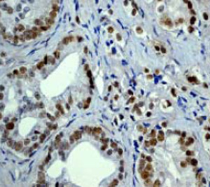 Immunohistochemistry (Formalin/PFA-fixed paraffin-embedded sections) - Anti-p53 (phospho S392) antibody [EP155Y] (ab33889), expandable thumbnail
