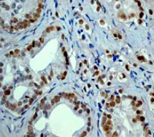Immunohistochemistry (Formalin/PFA-fixed paraffin-embedded sections) - Anti-p53 (phospho S392) antibody [EP155Y] (AB33889)