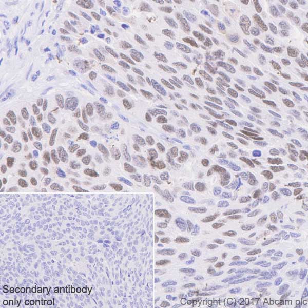 Immunohistochemistry (Formalin/PFA-fixed paraffin-embedded sections) - Anti-p53 (phospho S392) antibody [EP155Y] (AB33889), expandable thumbnail