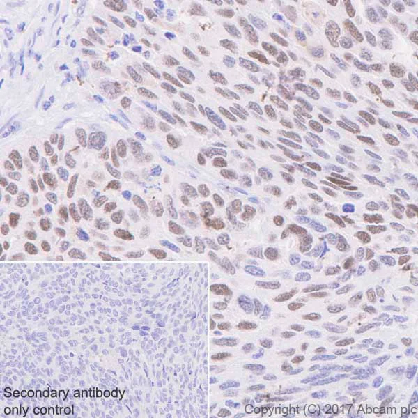 Immunohistochemistry (Formalin/PFA-fixed paraffin-embedded sections) - Anti-p53 (phospho S392) antibody [EP155Y] (AB33889)