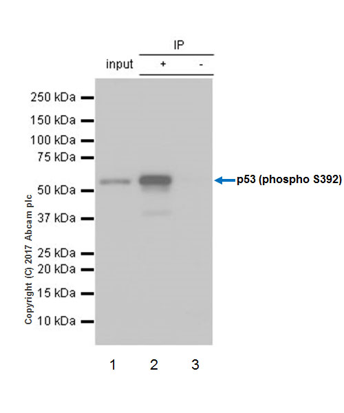 Immunoprecipitation - Anti-p53 (phospho S392) antibody [EP155Y] (AB33889), expandable thumbnail