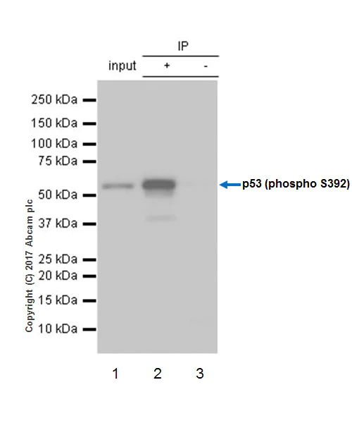 Immunoprecipitation - Anti-p53 (phospho S392) antibody [EP155Y] (AB33889)