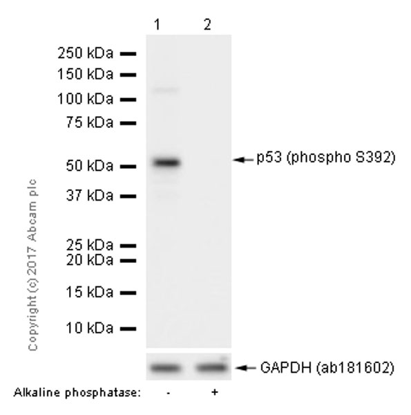 Western blot - Anti-p53 (phospho S392) antibody [EP155Y] (AB33889), expandable thumbnail