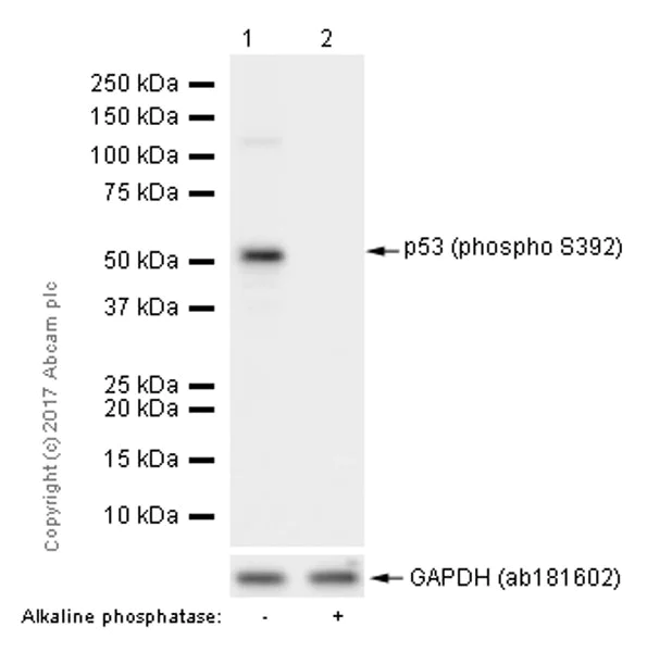 Western blot - Anti-p53 (phospho S392) antibody [EP155Y] (AB33889)