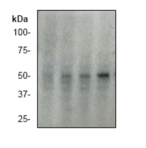 Western blot - Anti-p53 (phospho S392) antibody [EP155Y] (ab33889), expandable thumbnail