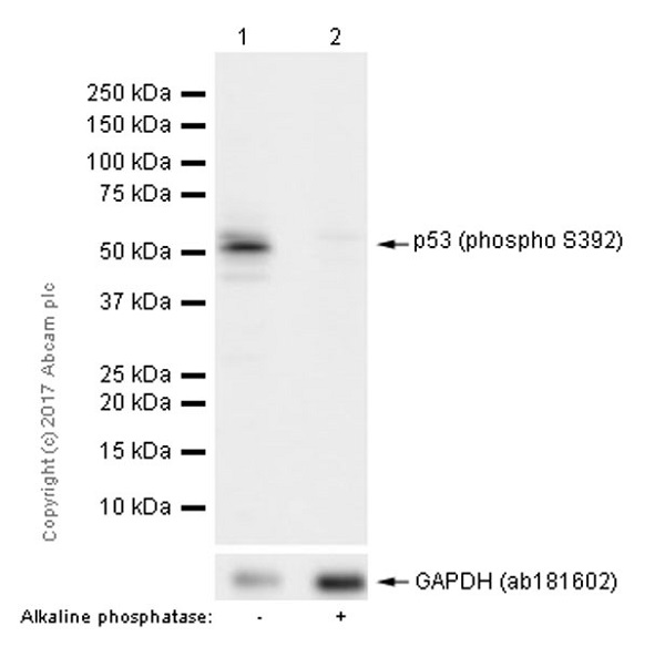 Western blot - Anti-p53 (phospho S392) antibody [EP155Y] (AB33889), expandable thumbnail