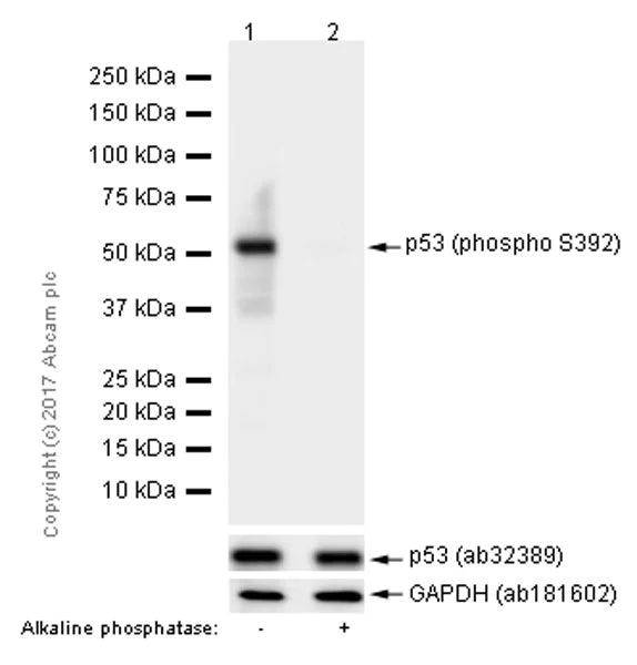 Western blot - Anti-p53 (phospho S392) antibody [EP155Y] - BSA and Azide free (AB239211)