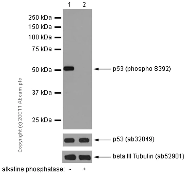 Western blot - Anti-p53 (phospho S392) antibody [EP155Y] - BSA and Azide free (AB239211)