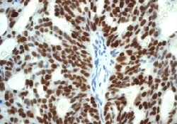 Immunohistochemistry (Formalin/PFA-fixed paraffin-embedded sections) - Anti-p53 (phospho S392) antibody [EP1889Y] (AB134190)
