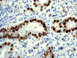 Immunohistochemistry (Formalin/PFA-fixed paraffin-embedded sections) - Anti-p53 (phospho S392) antibody [EP1889Y] (AB134190)