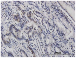 Immunohistochemistry (Formalin/PFA-fixed paraffin-embedded sections) - Anti-p53 (phospho S46) antibody [36] (AB122898)