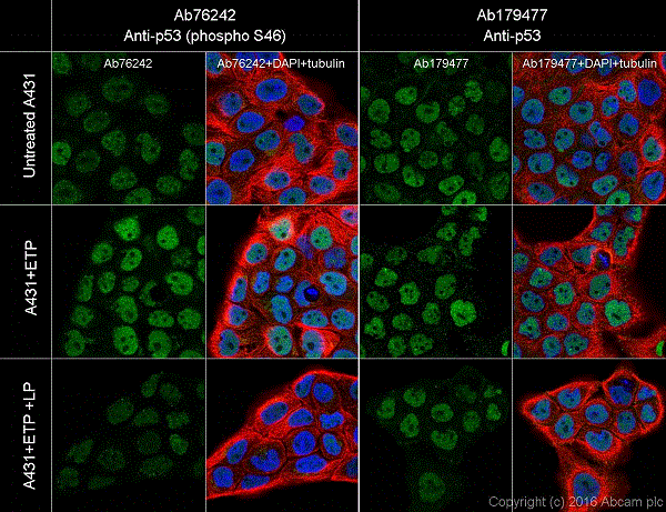 Immunocytochemistry/ Immunofluorescence - Anti-p53 (phospho S46) antibody [EP42Y] (AB76242), expandable thumbnail