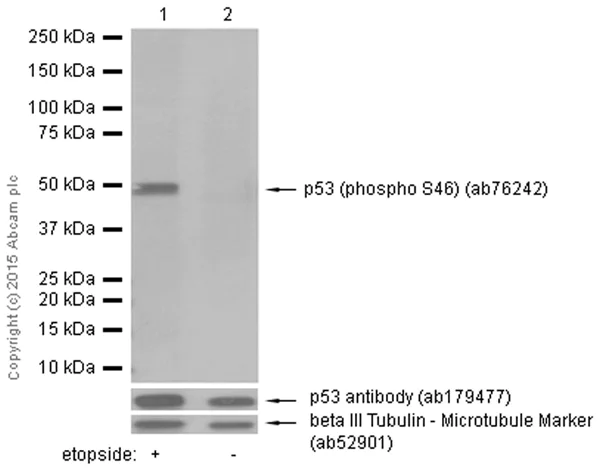 Western blot - Anti-p53 (phospho S46) antibody [EP42Y] (AB76242)