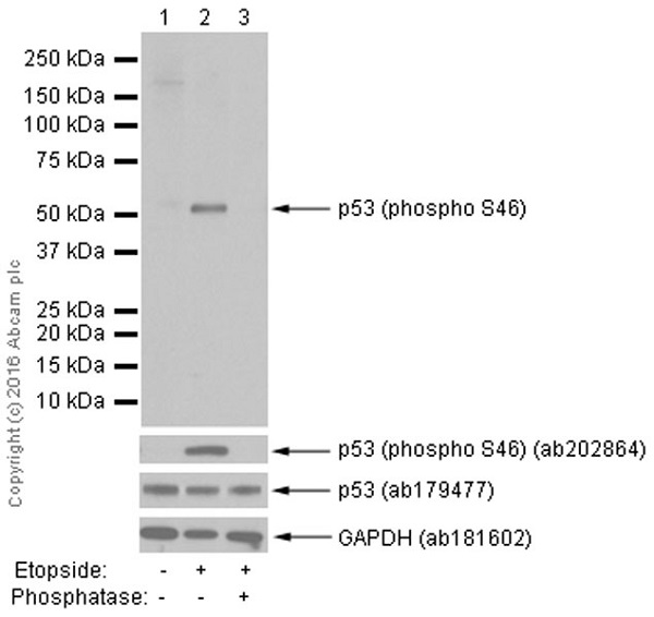 Western blot - Anti-p53 (phospho S46) antibody [EP42Y] (AB76242), expandable thumbnail