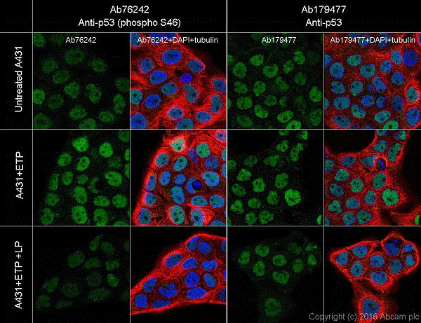 Immunocytochemistry/ Immunofluorescence - Anti-p53 (phospho S46) antibody [EP42Y] - BSA and Azide free (AB239880)