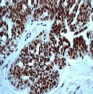 Immunohistochemistry (Formalin/PFA-fixed paraffin-embedded sections) - Anti-p53 (phospho S46) antibody [EP42Y] - BSA and Azide free (AB239880)