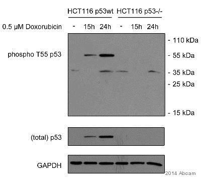 Western blot - Anti-p53 (phospho T55) antibody [EPR17729] (AB183546)
