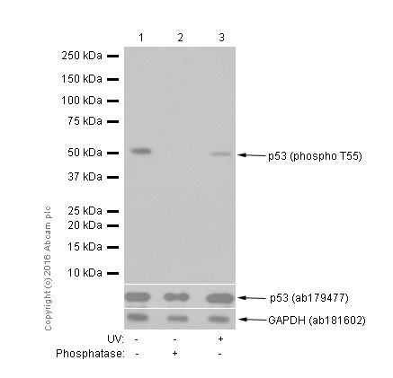 Western blot - Anti-p53 (phospho T55) antibody [EPR17729] (AB183546)