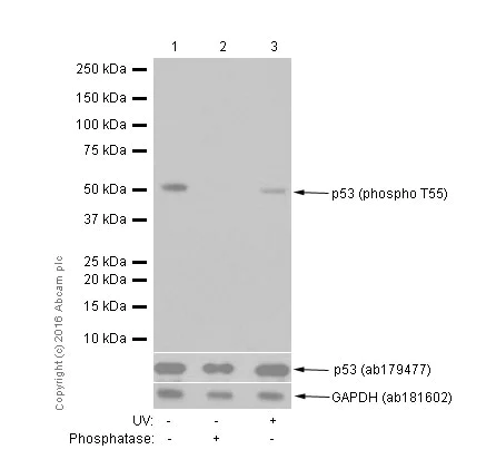 Western blot - Anti-p53 (phospho T55) antibody [EPR17729] - BSA and Azide free (AB250672)