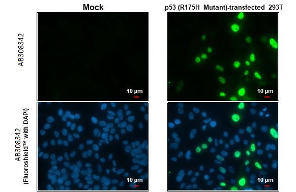 Immunocytochemistry/ Immunofluorescence - Anti-p53 R175H Mutant antibody [HL1129] (AB308342), expandable thumbnail
