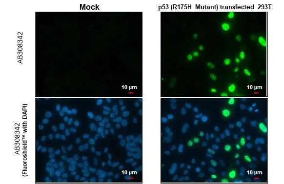 Immunocytochemistry/ Immunofluorescence - Anti-p53 R175H Mutant antibody [HL1129] (AB308342)