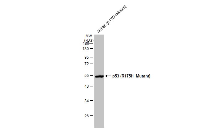 Western blot - Anti-p53 R175H Mutant antibody [HL1129] (AB308342), expandable thumbnail