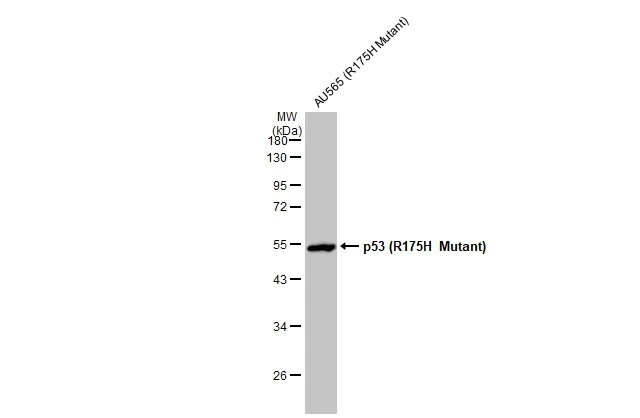 Western blot - Anti-p53 R175H Mutant antibody [HL1129] (AB308342)