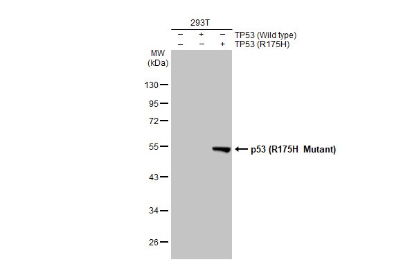 Western blot - Anti-p53 R175H Mutant antibody [HL1129] (AB308342), expandable thumbnail